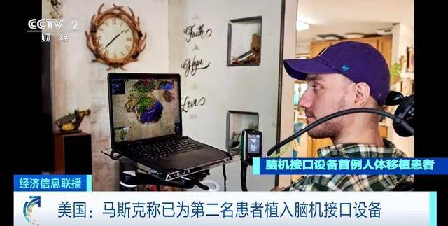 马斯克：成功为第二名患者植入脑机接口设备 